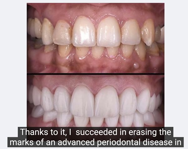 How Is Dentitox Pro Effective?